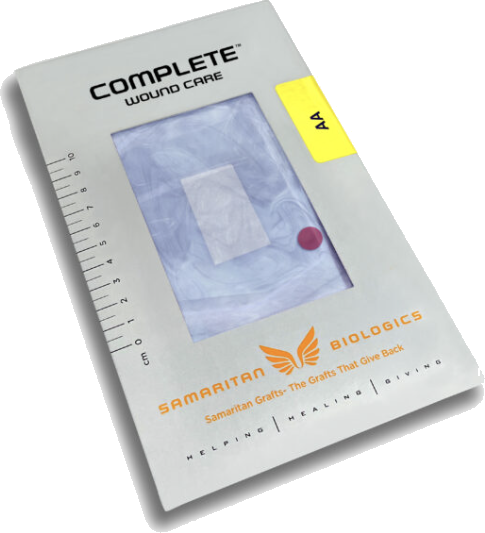 Complete AA amniotic allograft