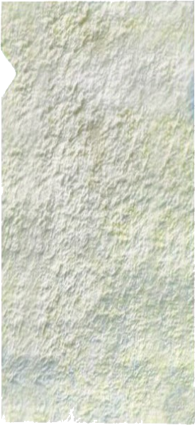 Complete SL amniotic allograft