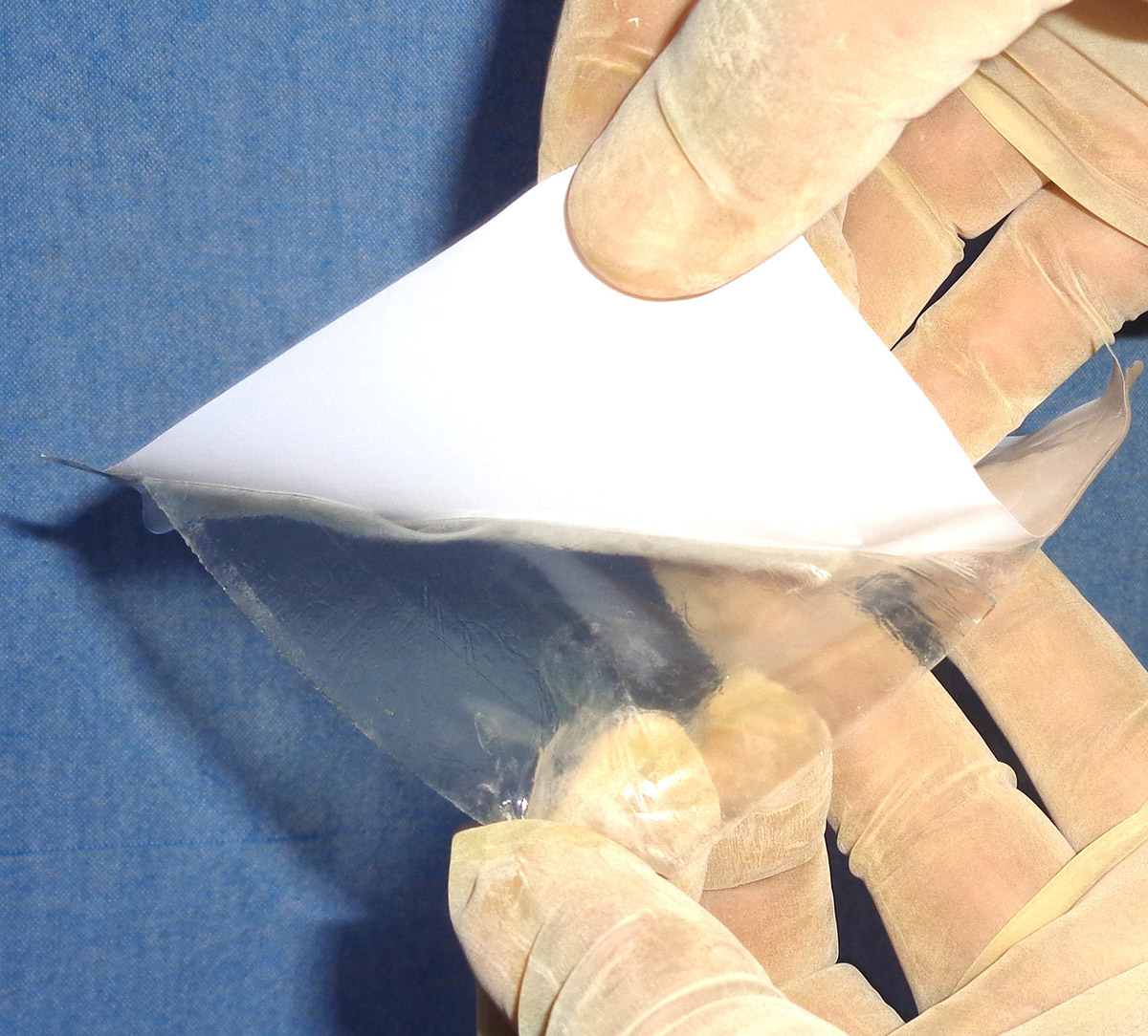 Helicoll amniotic allograft
